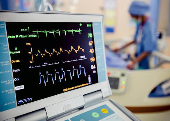 Heart monitor screen in a hospital room